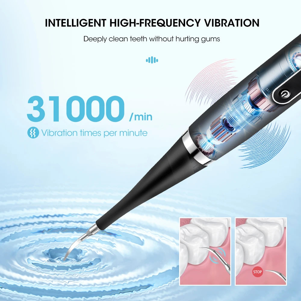 Electric Dental Scaler & Sonic Toothbrush – 5-Mode Teeth Whitening Cleaner