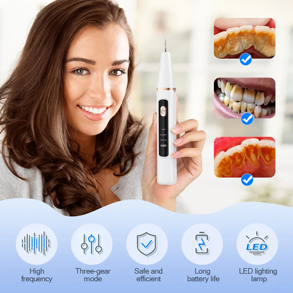 Ultrasonic Dental Scaler – Electric Plaque Remover & Teeth Whitening Tool