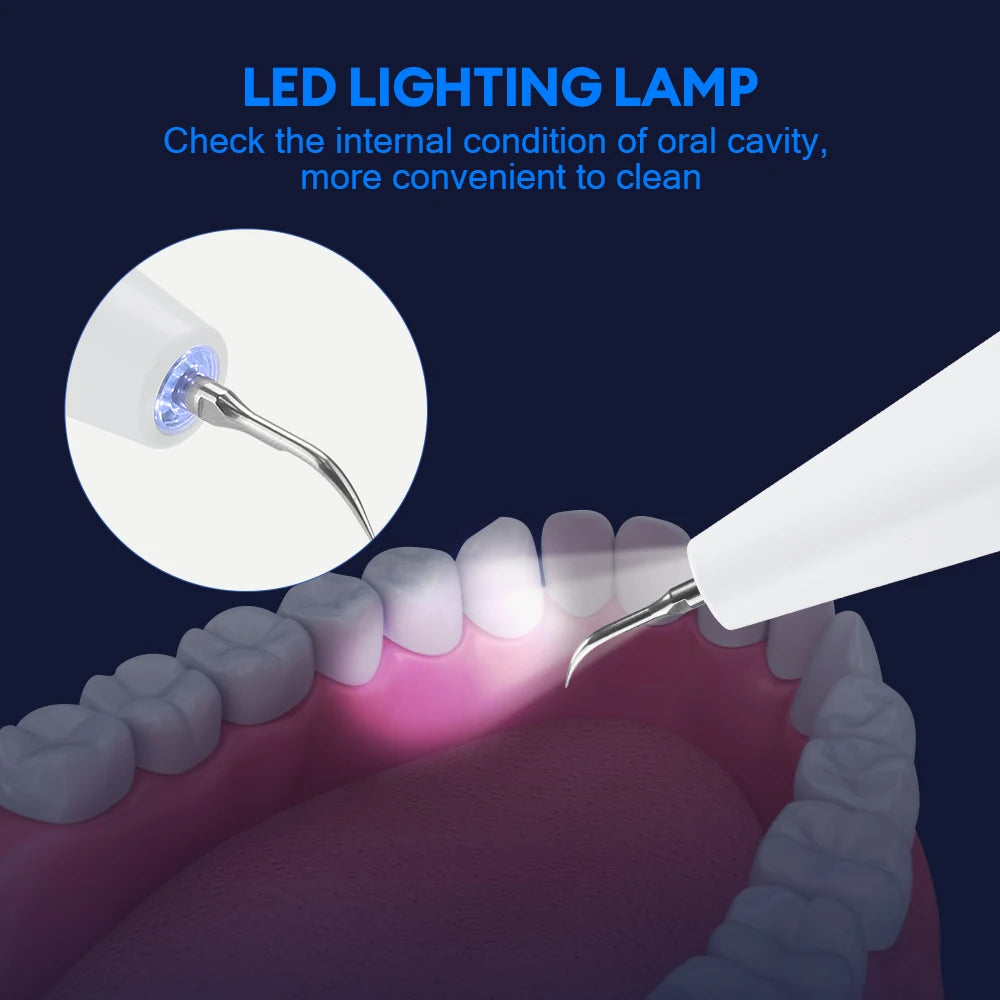 Ultrasonic Dental Scaler – Electric Plaque Remover & Teeth Whitening Tool